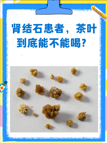 喝茶叶会得肾结石？3 个喝法定风险，别瞎喝慌了神-茶之家